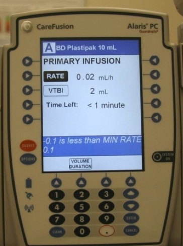 Bugs in a CareFusion infusion pump